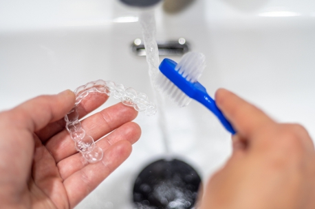 Quick Aligner Treatment at Illusion Aligners